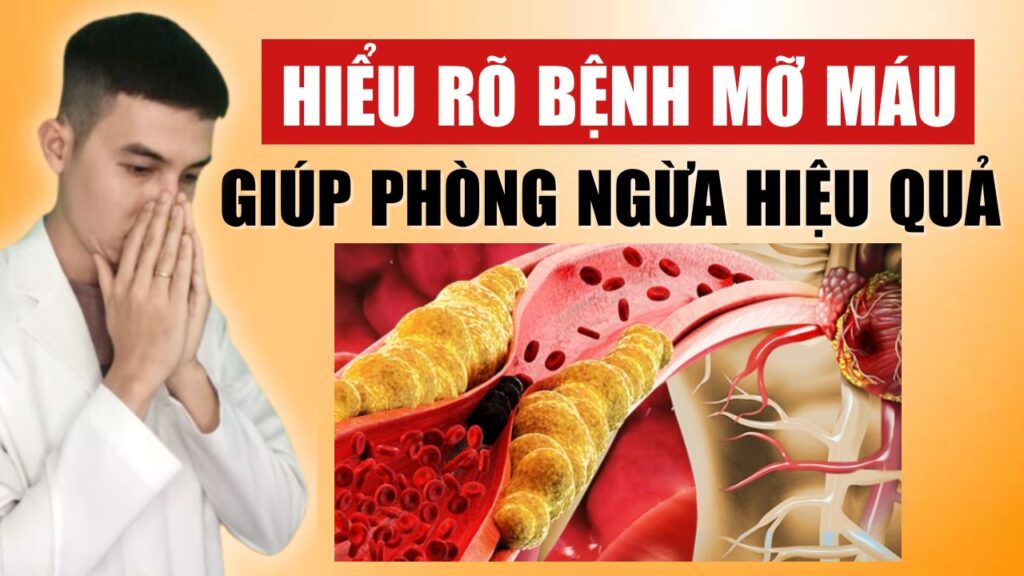 Bệnh mỡ máu Dược sĩ Đạt