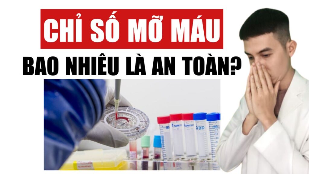 Chỉ số mỡ máu Dược Sĩ Đạt