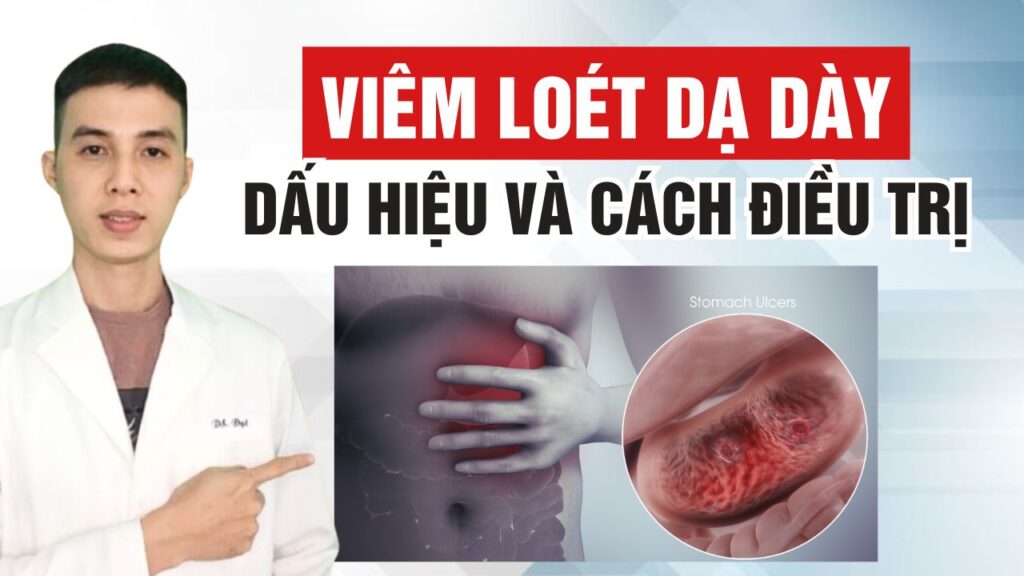 Viêm loét dạ dày là gì? Dược sĩ Đạt