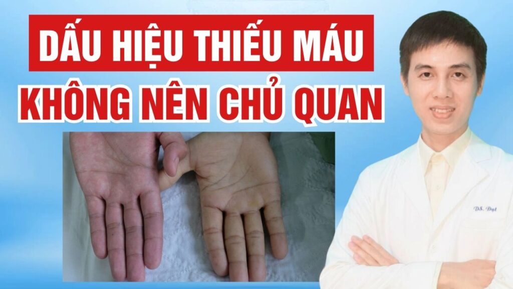 Dấu hiệu thiếu máu Dược sĩ Đạt