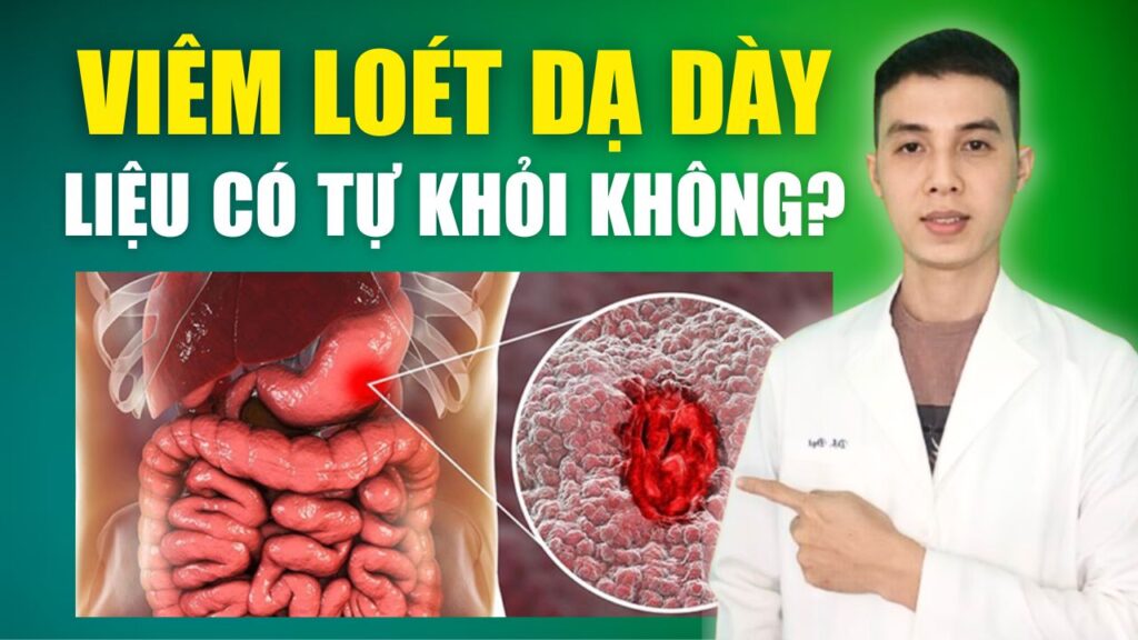 Viêm loét dạ dày có tự khỏi Dược sĩ Đạt