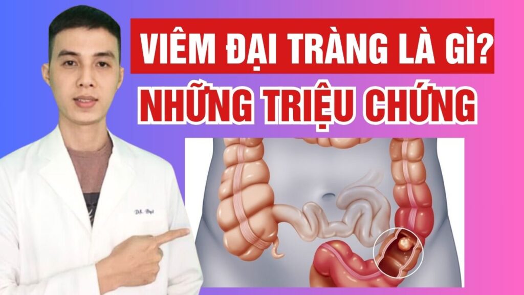 Viêm đại tràng là gì? dược sĩ đạt